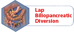 Lap Biliopancreatic Diversion