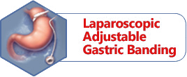 Laparoscopic Adjustable Gastric Banding