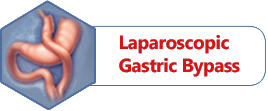 Laparoscopic Gastric Bypass